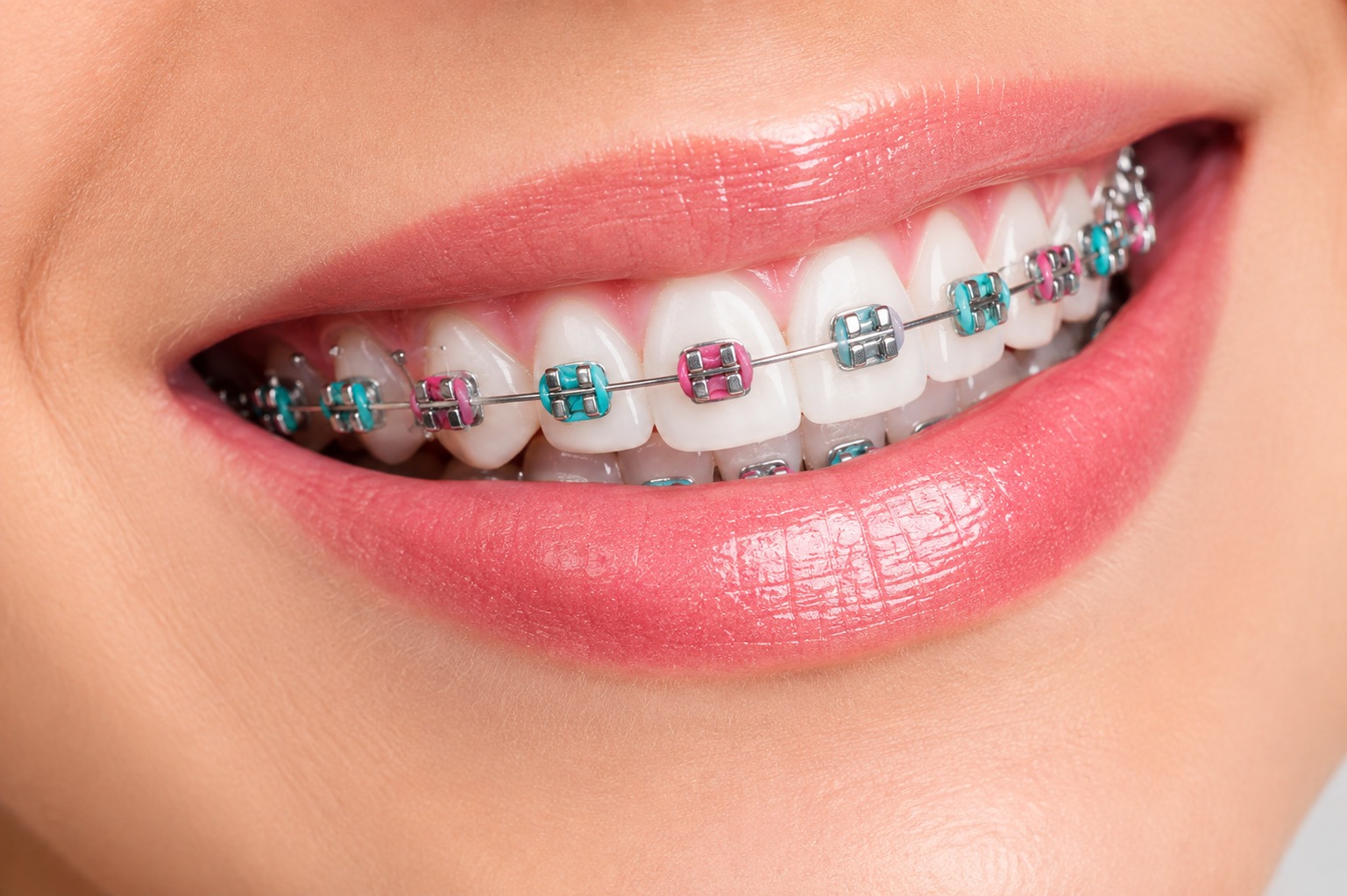 What does an Orthodontist do