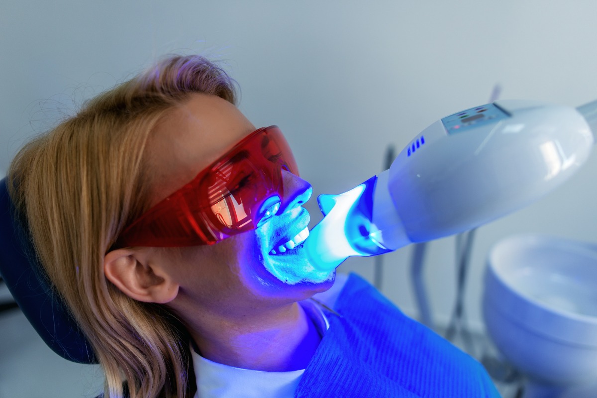 Teeth Whitening Laser Whitening at Four Seasons Dental Surat